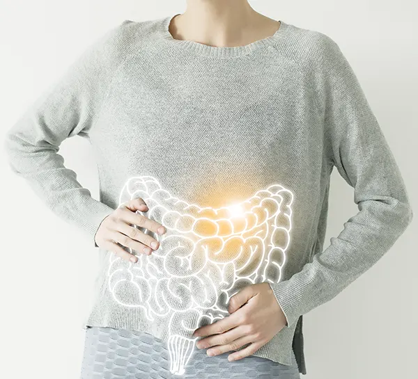 Enfermedad Inflamatoria Intestinal